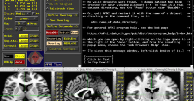 The five windows that make up AFNIs graphical user interface - The Conversation